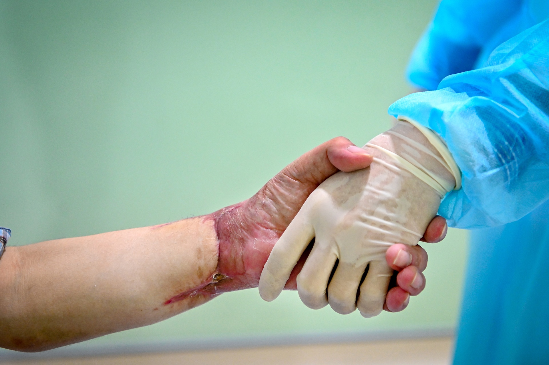 ca ghep chi the song anh 10