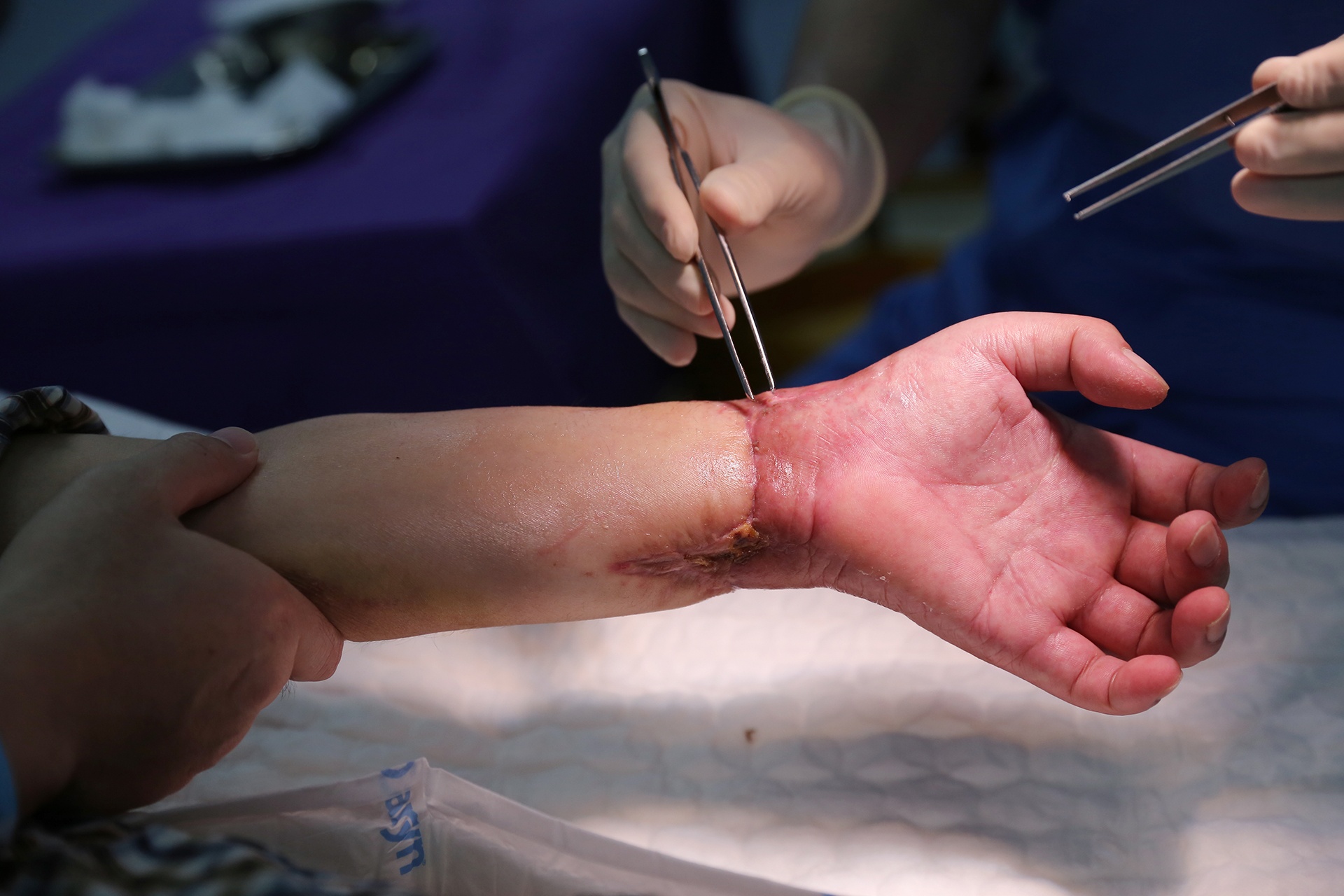 ca ghep chi the song anh 7