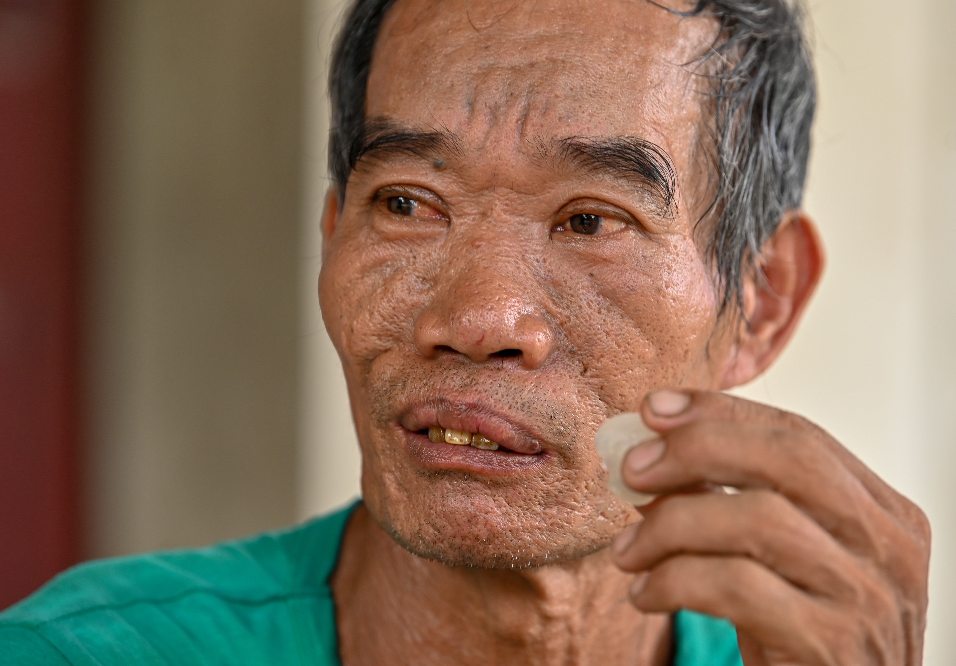 bãi rác Nam Sơn ô nhiễm ảnh 7 bai rac Nam Son o nhiem anh 7