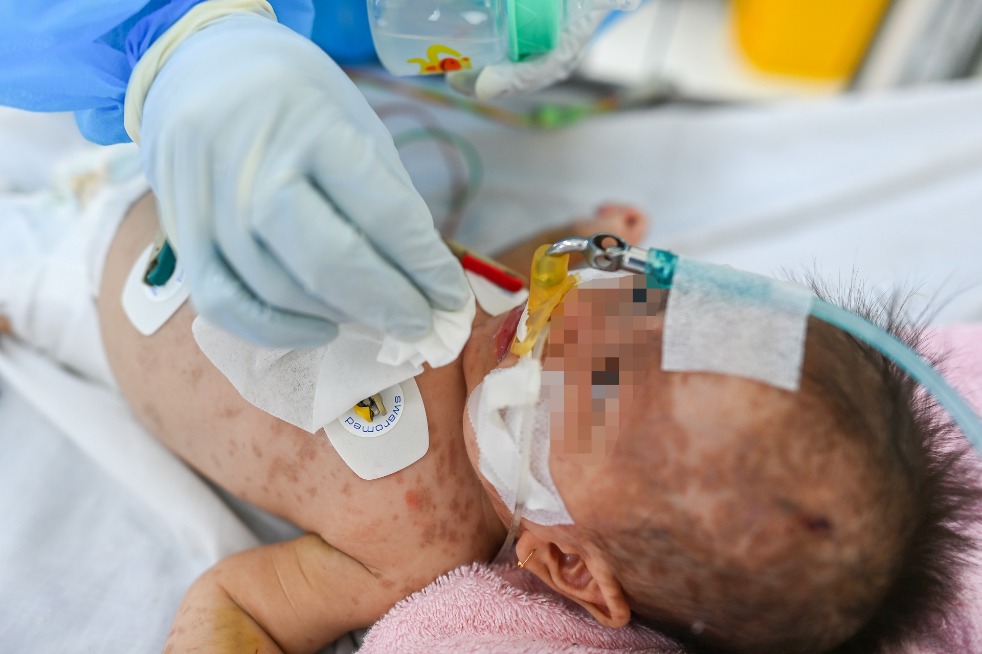 Trung tam hoi suc Covid-19 o Binh Duong anh 12