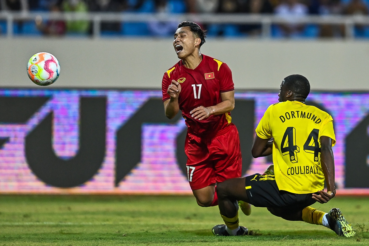 Cau gon dortmund su co anh 1