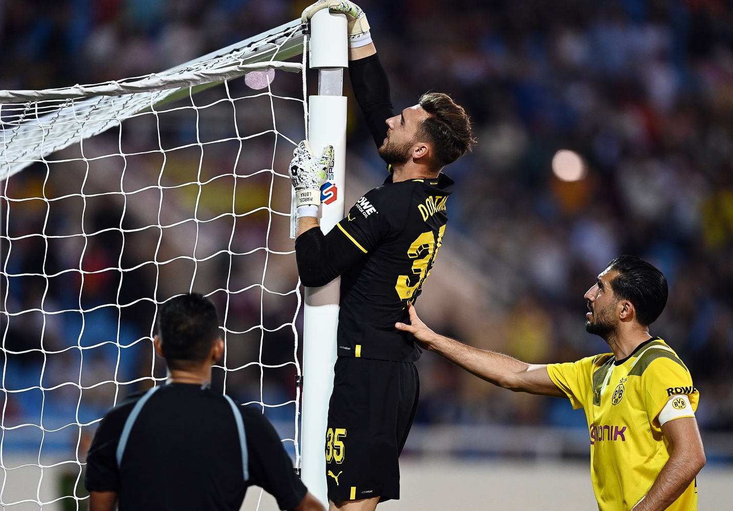 Cau gon dortmund su co anh 4