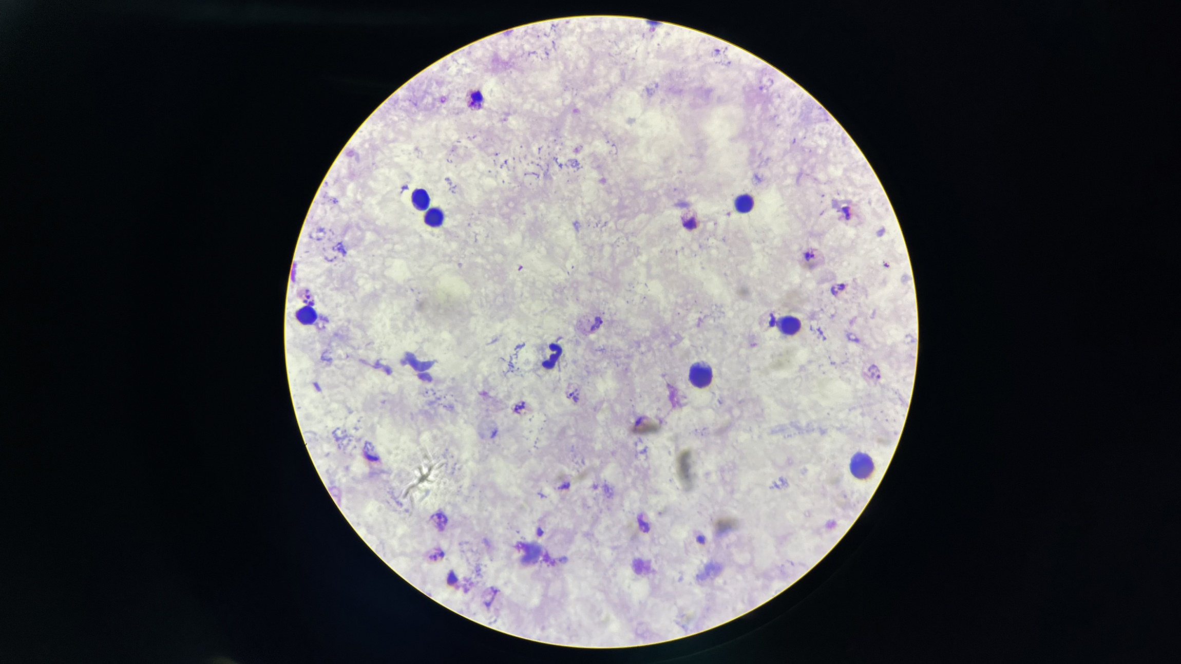 Bệnh bị lãng quên ảnh 1 Benh bi lang quen anh 1