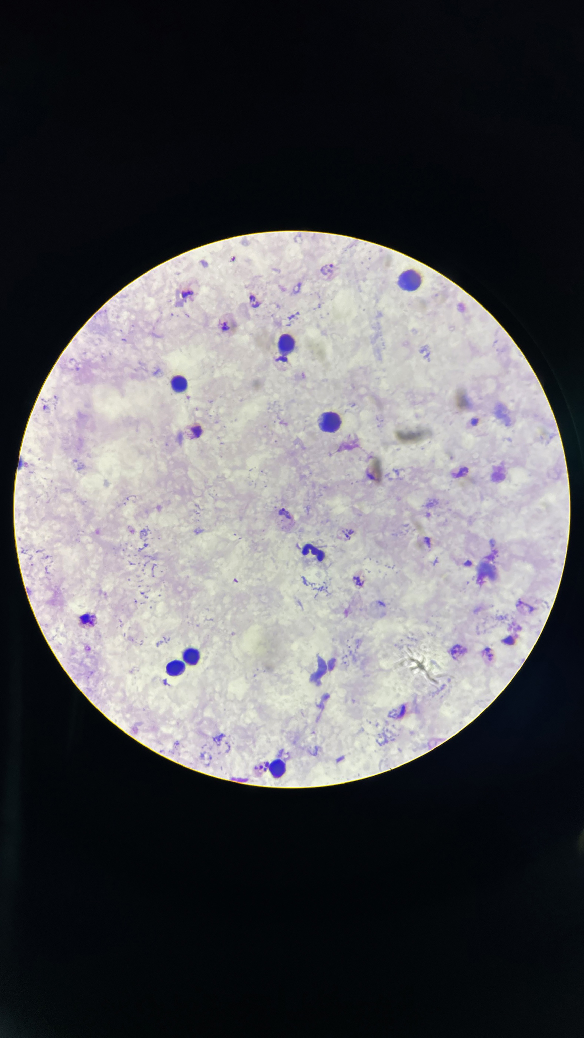 Bệnh bị lãng quên ảnh 2 Benh bi lang quen anh 2