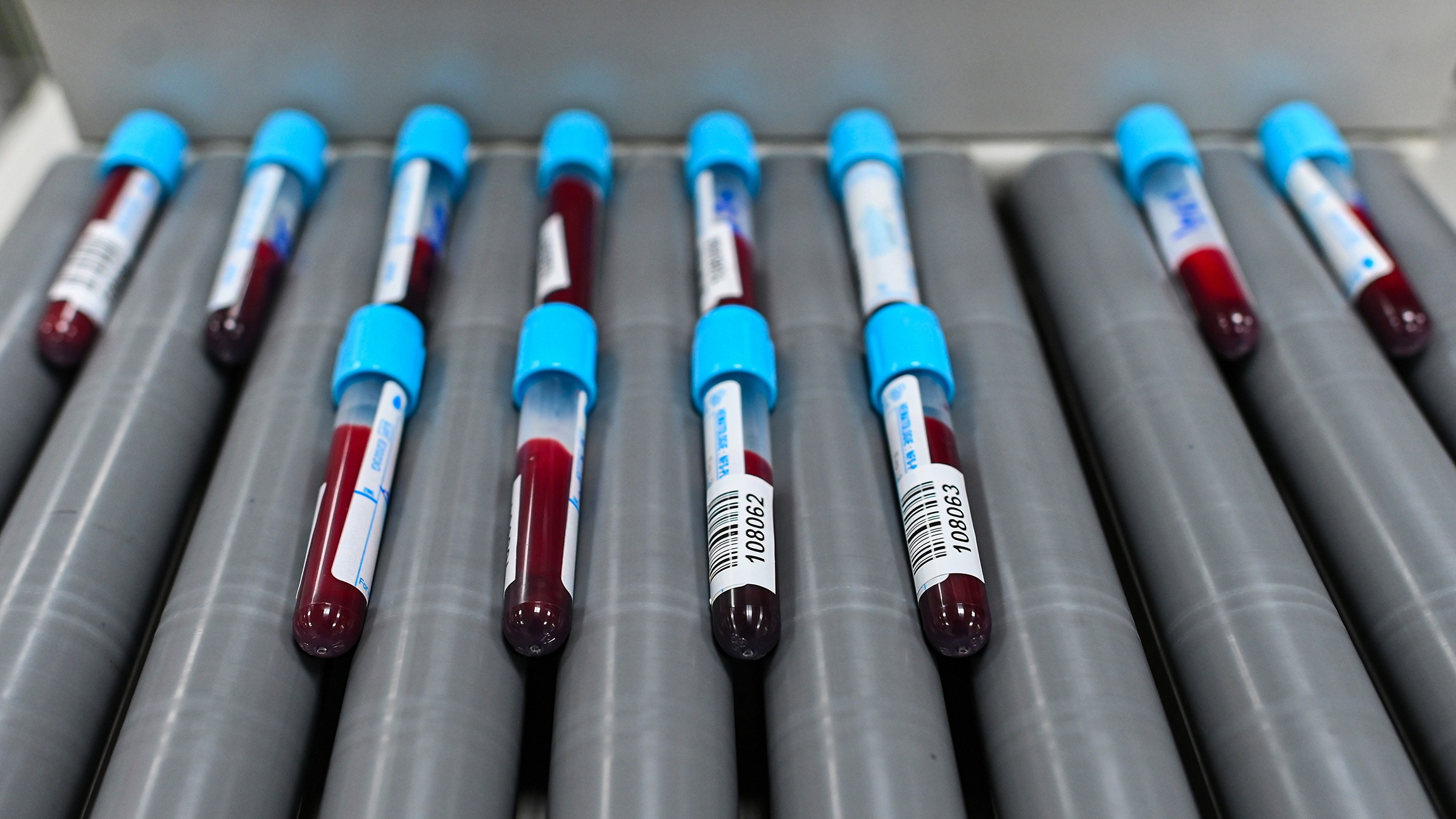 Benh bi lang quen anh 9