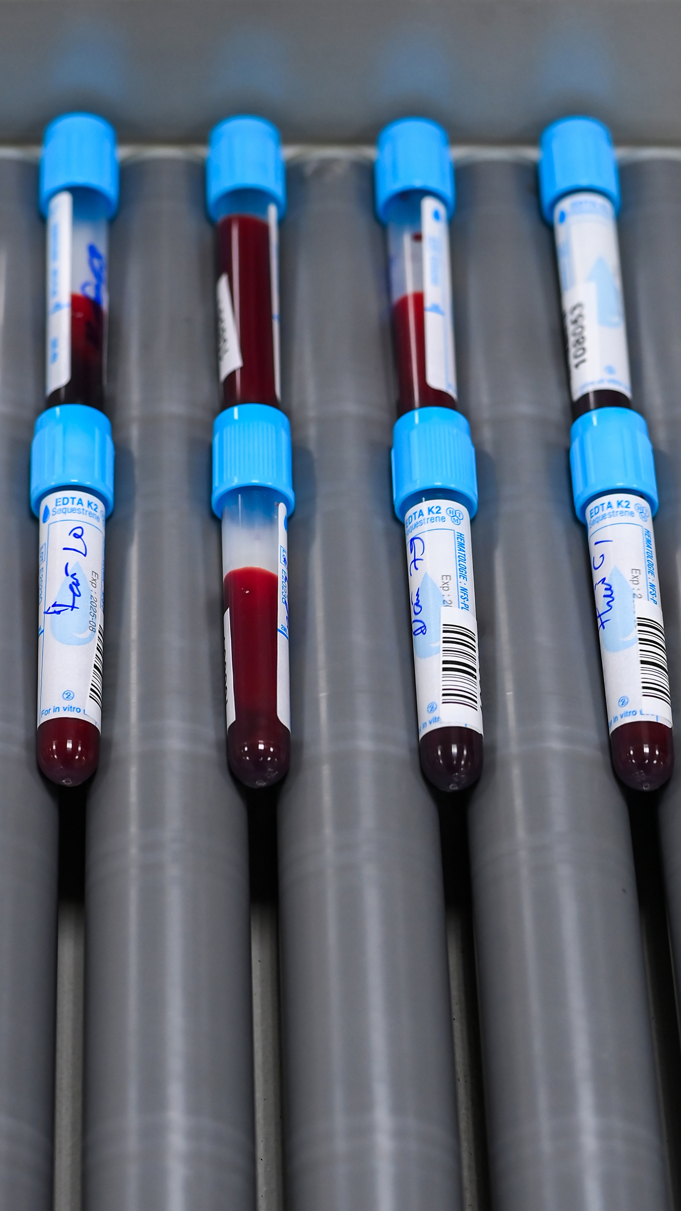 Benh bi lang quen anh 10