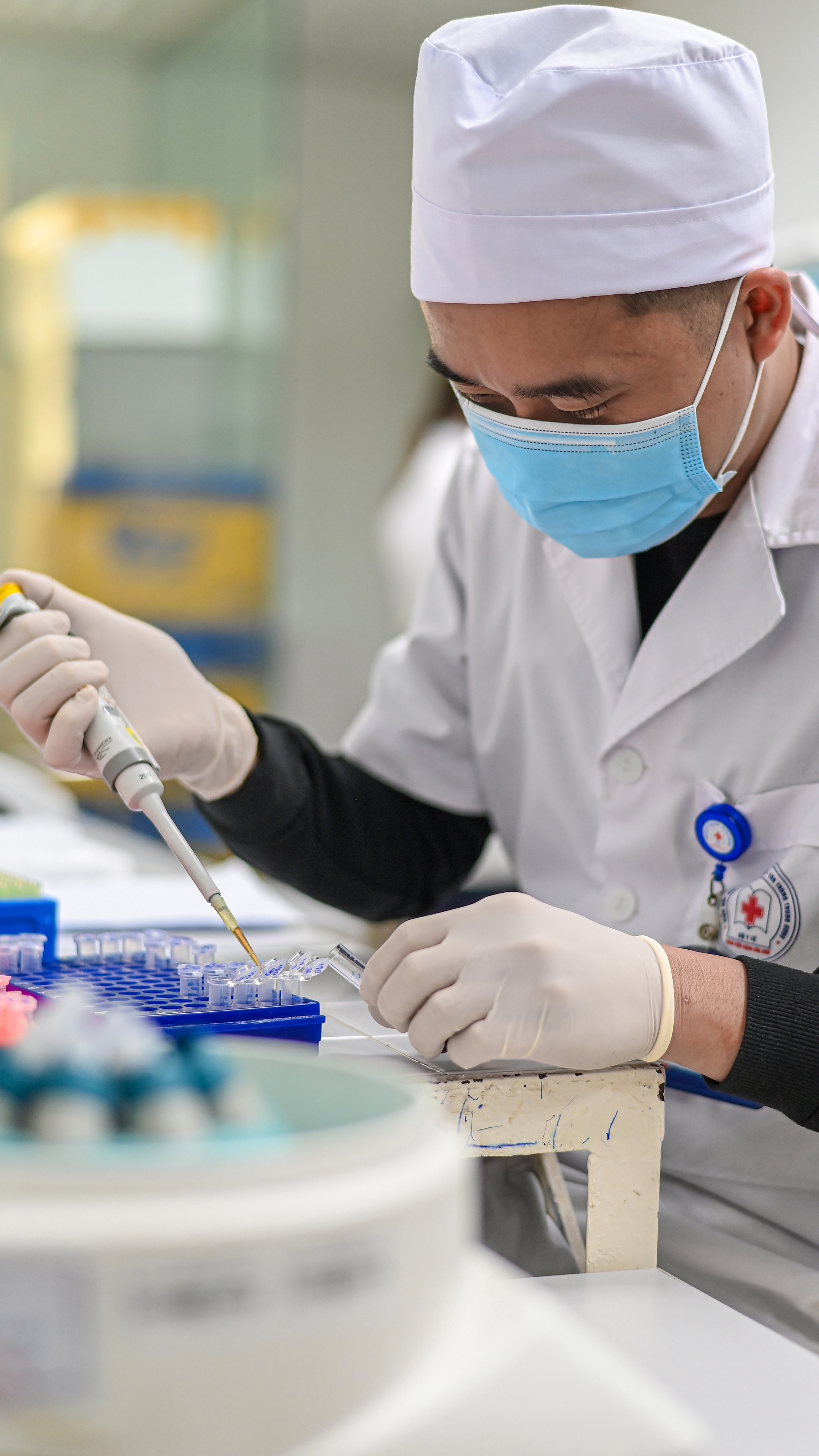 Benh bi lang quen anh 12