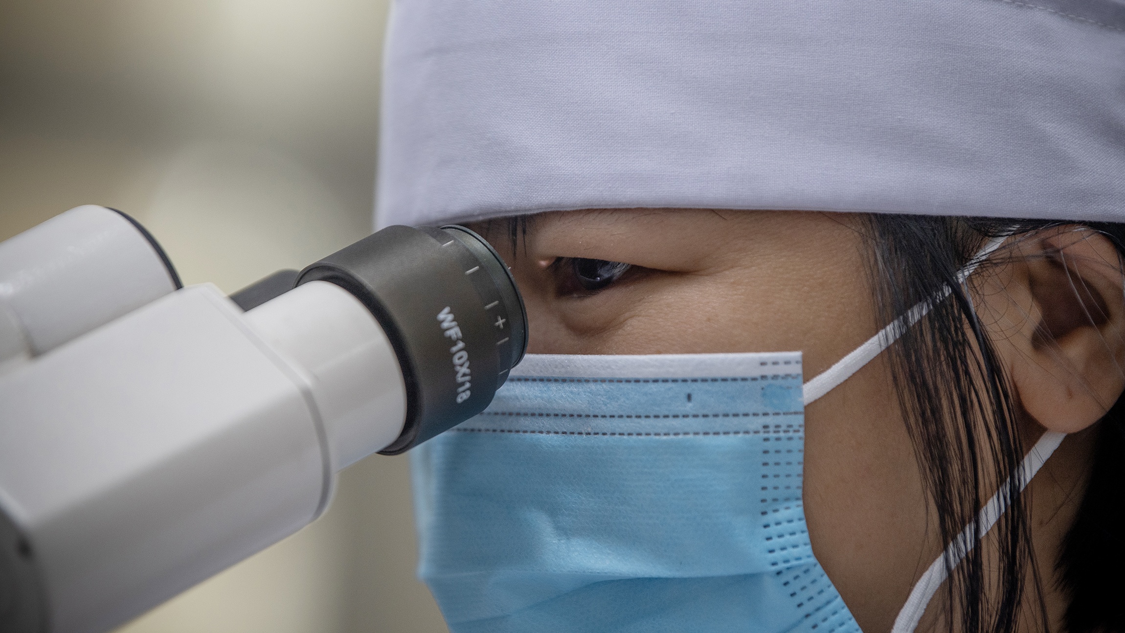 Bệnh bị lãng quên ảnh 15 Benh bi lang quen anh 15