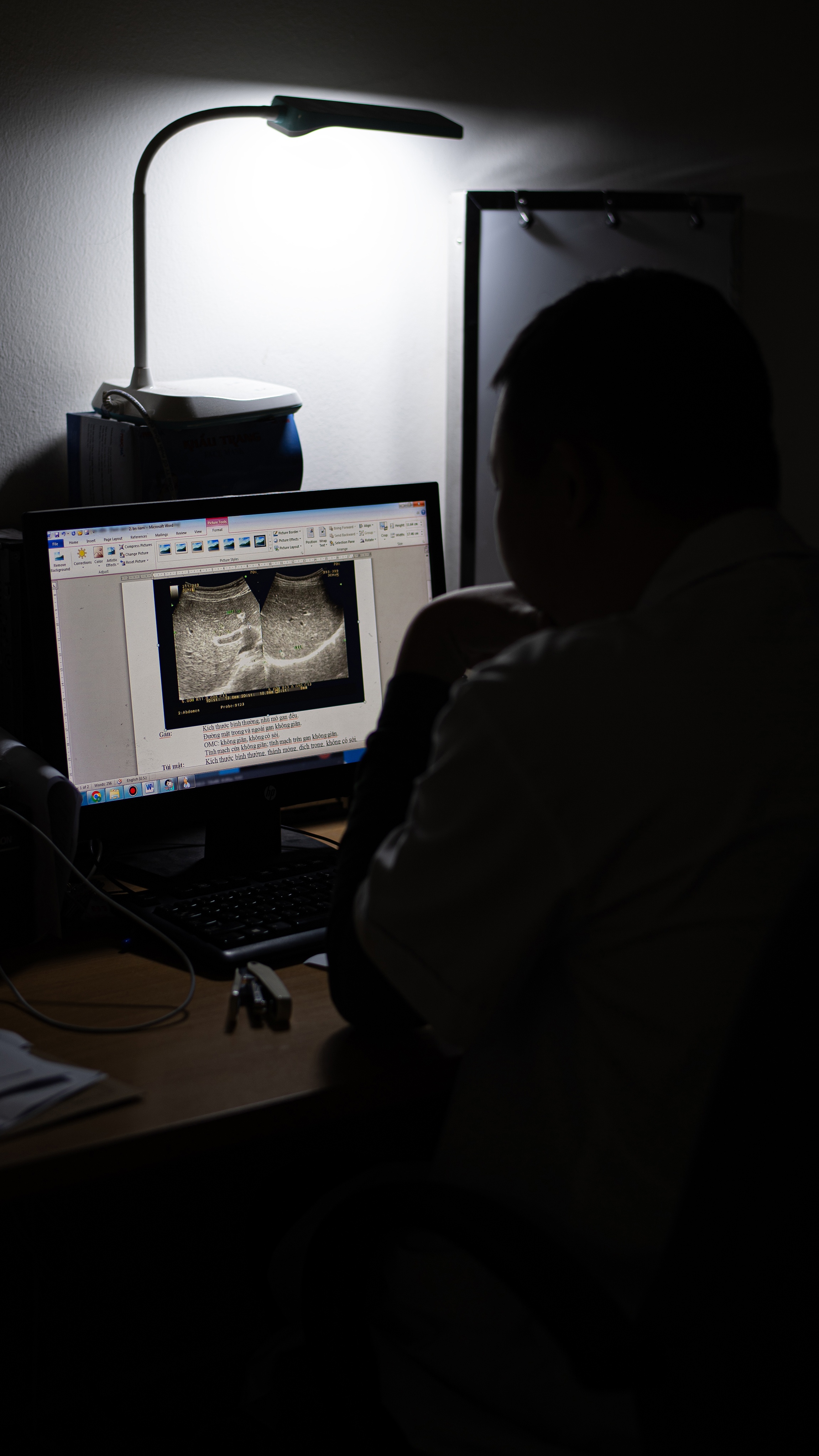 Bệnh bị lãng quên ảnh 14 Benh bi lang quen anh 14