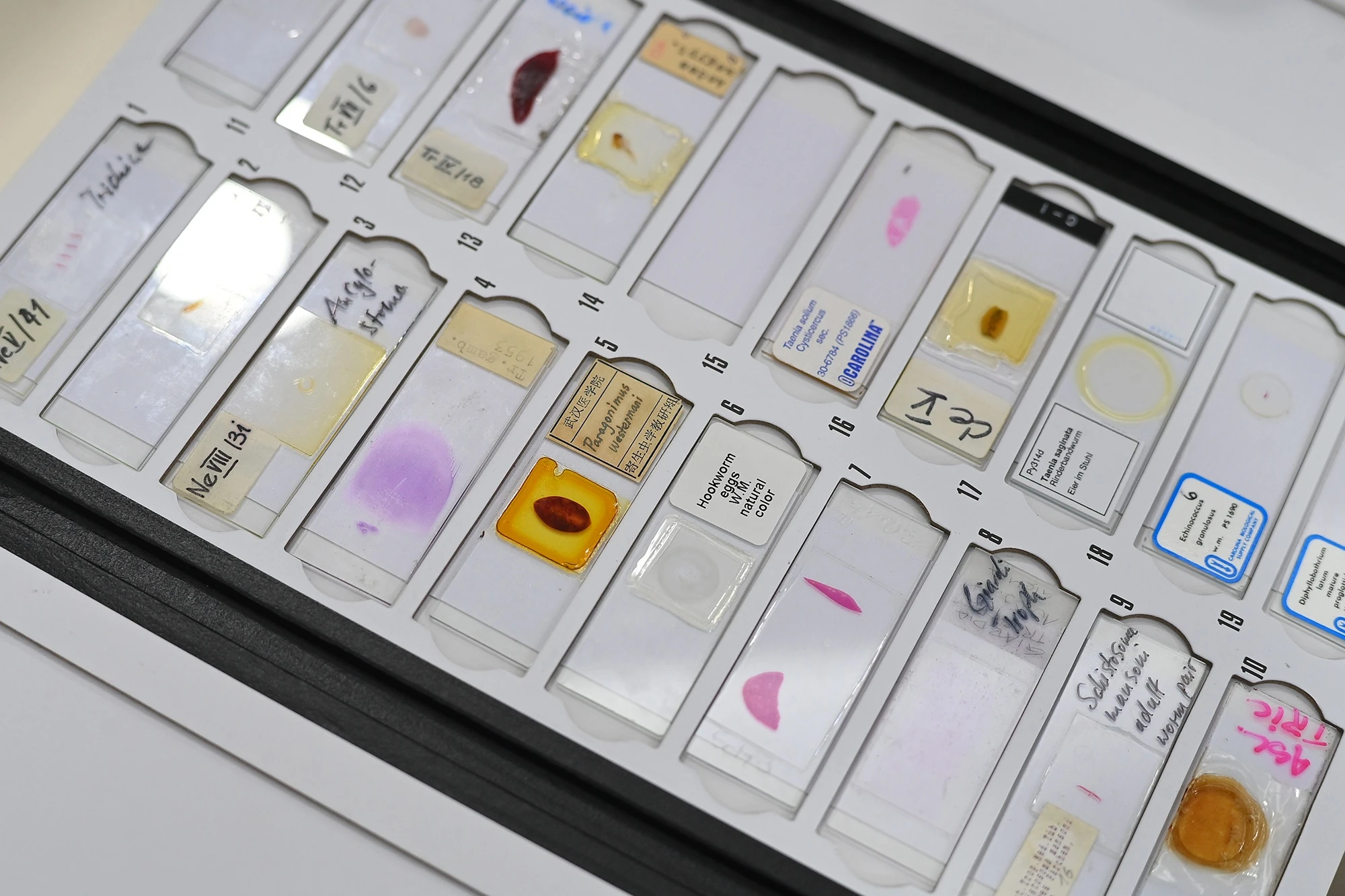 Khoa truyen nhiem vien 108 anh 29