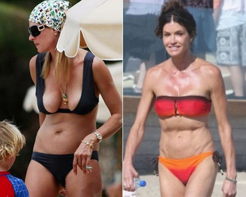 11 my nhan mac bikini xau nhat the gioi hinh anh