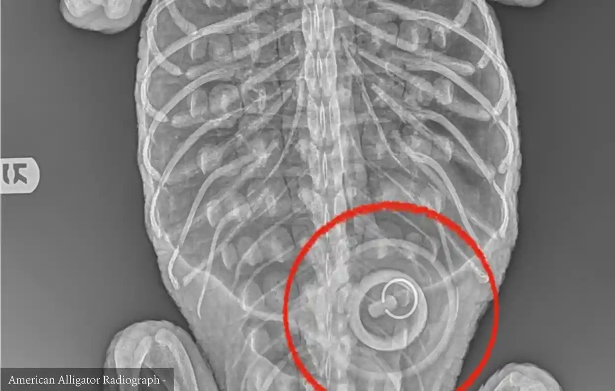 Nut chan bon tam rong 10 cm ket trong bung ca sau New York hinh anh