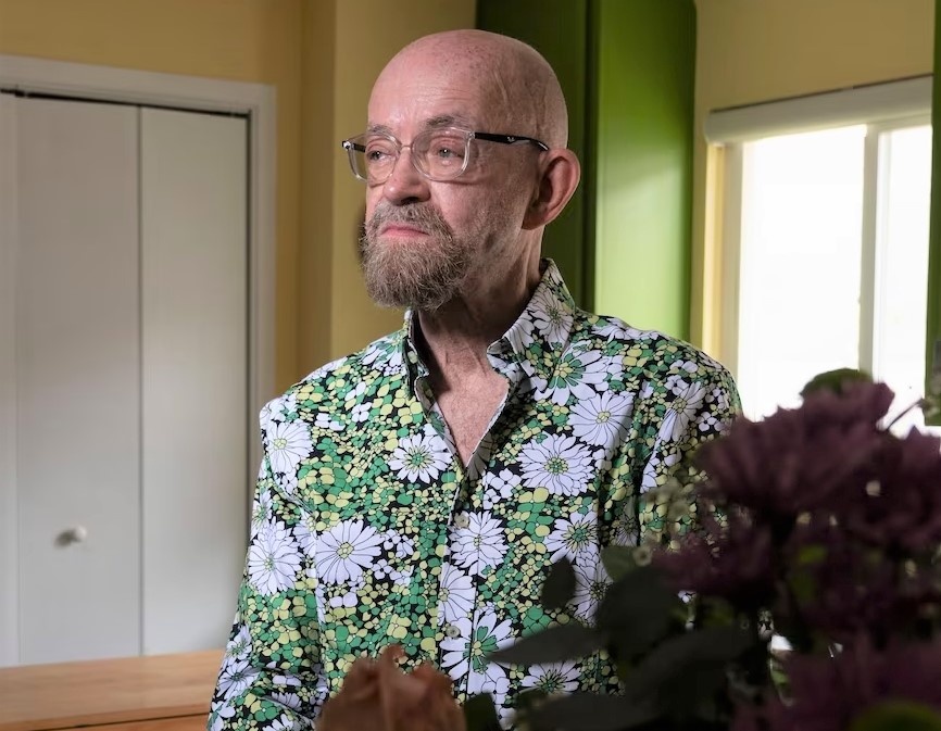 Phep mau voi benh nhan mac HIV hon 30 nam hinh anh