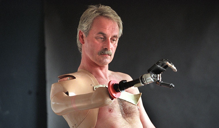 Chang duong phat trien cua nhung canh tay sinh hoc hinh anh