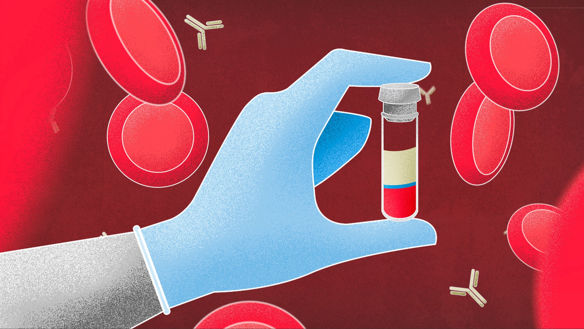 Mau cua benh nhan khoi benh Covid-19 co gia ban 1.000 USD/ml hinh anh