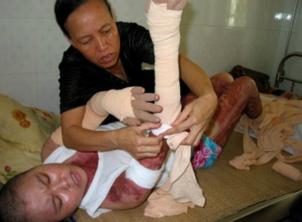 Nghi luc phi thuong cua co gai hoa chat hinh anh