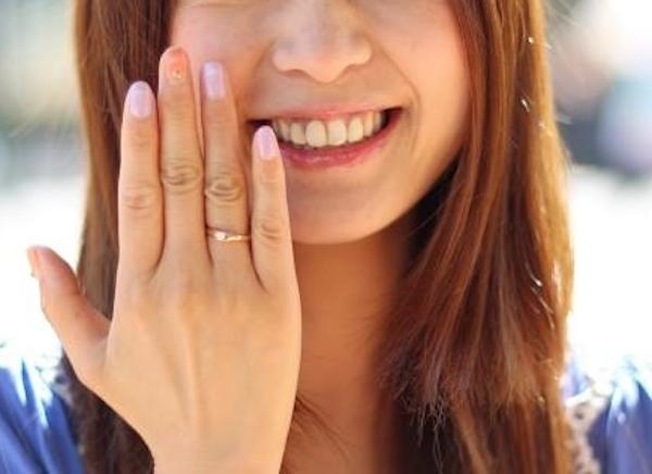Gioi tre ro mot phau thuat ngon tay deo nhan cuoi hinh anh