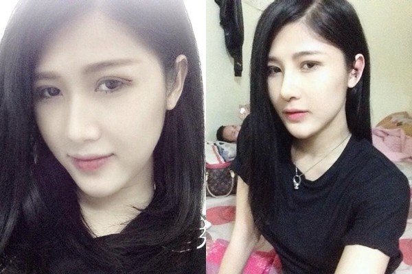 Và sau khi chịu khá nhiều đau đớn, Hiếu đã sở hữu gương mặt trái xoan, đôi mắt sâu cuốn hút, sống mũi thẳng rất 