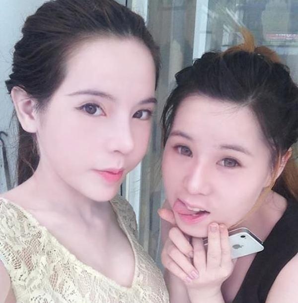 Hình ảnh của cặp chị em sau khi V. phẫu thuật thẩm mỹ, và em gái của cô khi chưa phẫu thuật hoàn chỉnh. 