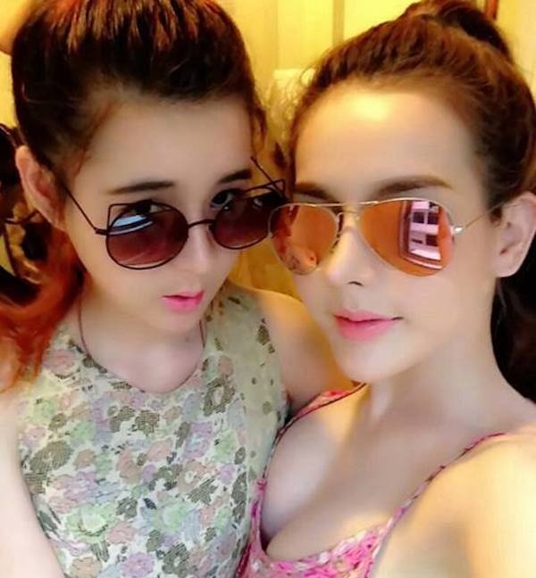 Bức ảnh hai chị em chụp chung khi cô em gái đã thay đổi hoàn toàn khi gọt hàm, niềng lại răng. 