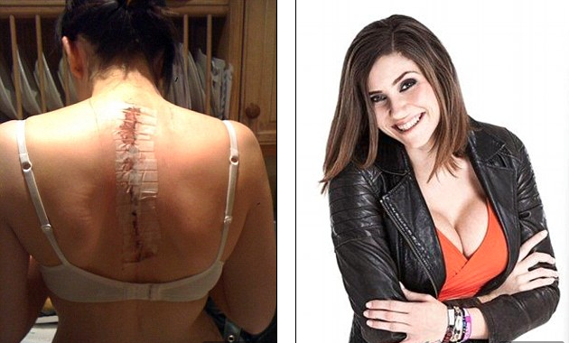 Co gai chiu dau don phau thuat song lung, nang nguc hinh anh