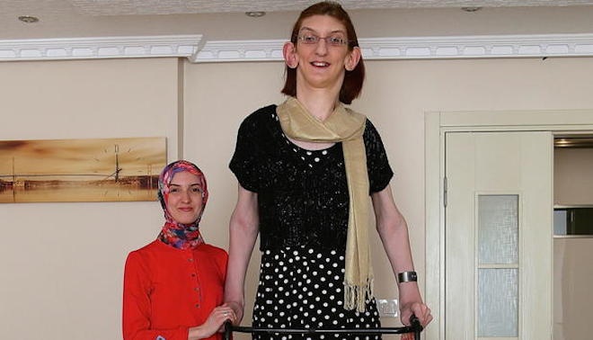 Cuoc song cua co gai 17 tuoi 2,13 m - cao nhat the gioi hinh anh