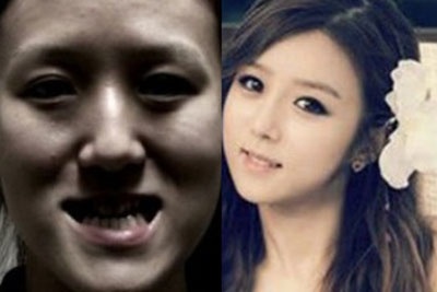 10 cu lot xac than ky nho phau thuat tham my hinh anh