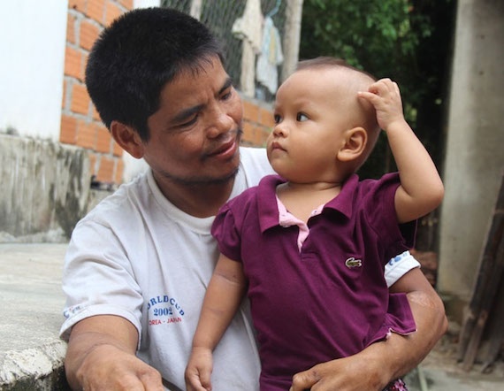 Chang trai benh phong cuoi vo bang…nhan gia hinh anh