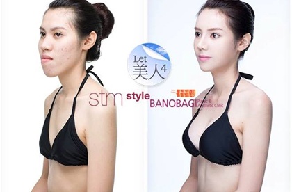 Nhung man lot xac vit hoa thien nga than ky nho dao keo hinh anh