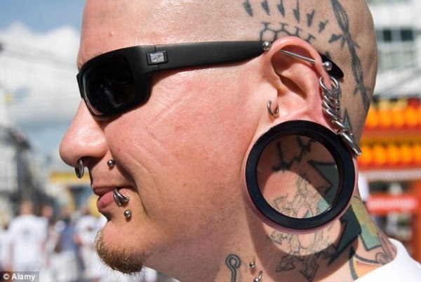 Gioi tre mat hon 60 trieu dong de chua vet nong tai hinh anh