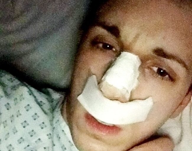 Phau thuat giong than tuong, chang trai bi doa giet hinh anh