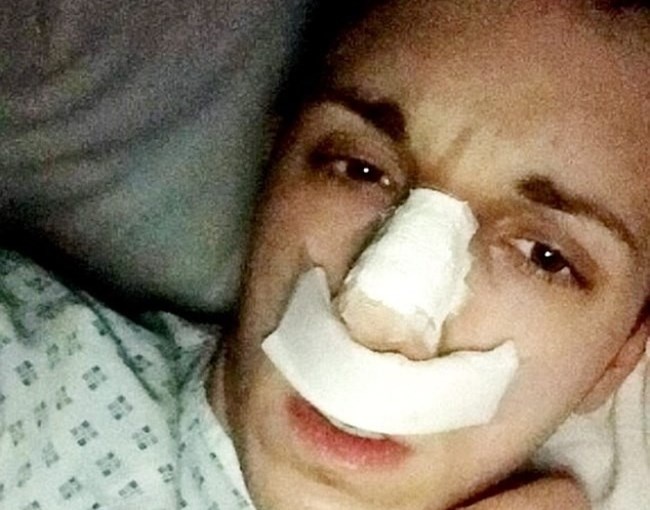 9X pha san vi nghien phau thuat tham my hinh anh