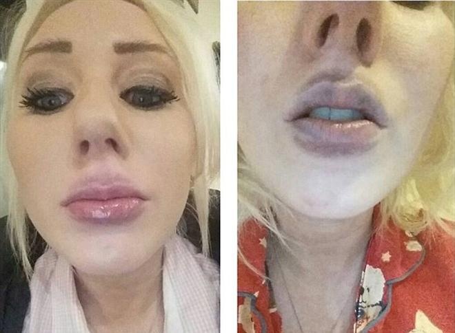 Dung do khong ro xuat xu, co gai bi sung tim moi hinh anh