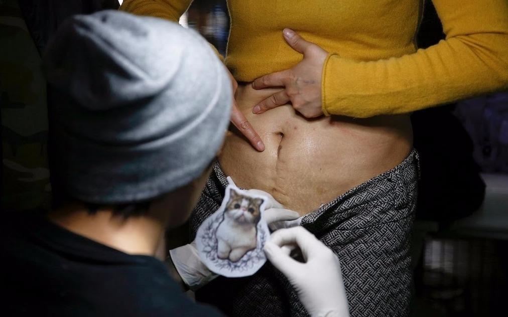 Phu nu Trung Quoc xam minh de che vet mo sau sinh hinh anh