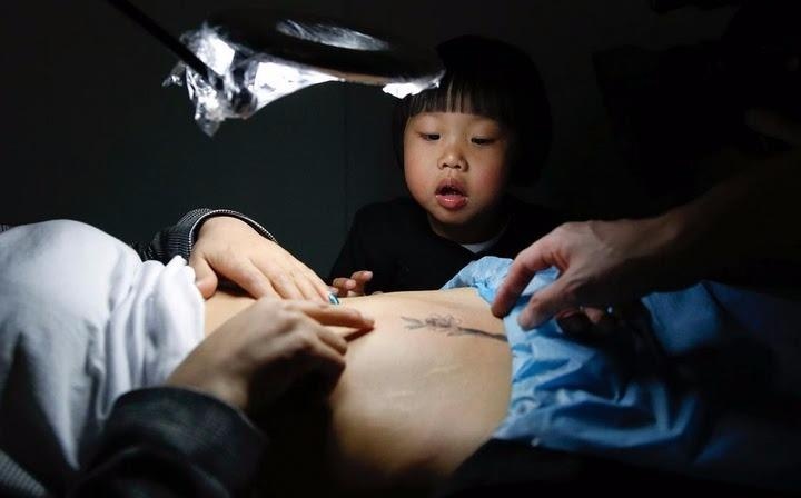 Xu huong dung hinh xam che vet mo cua phu nu Trung Quoc hinh anh