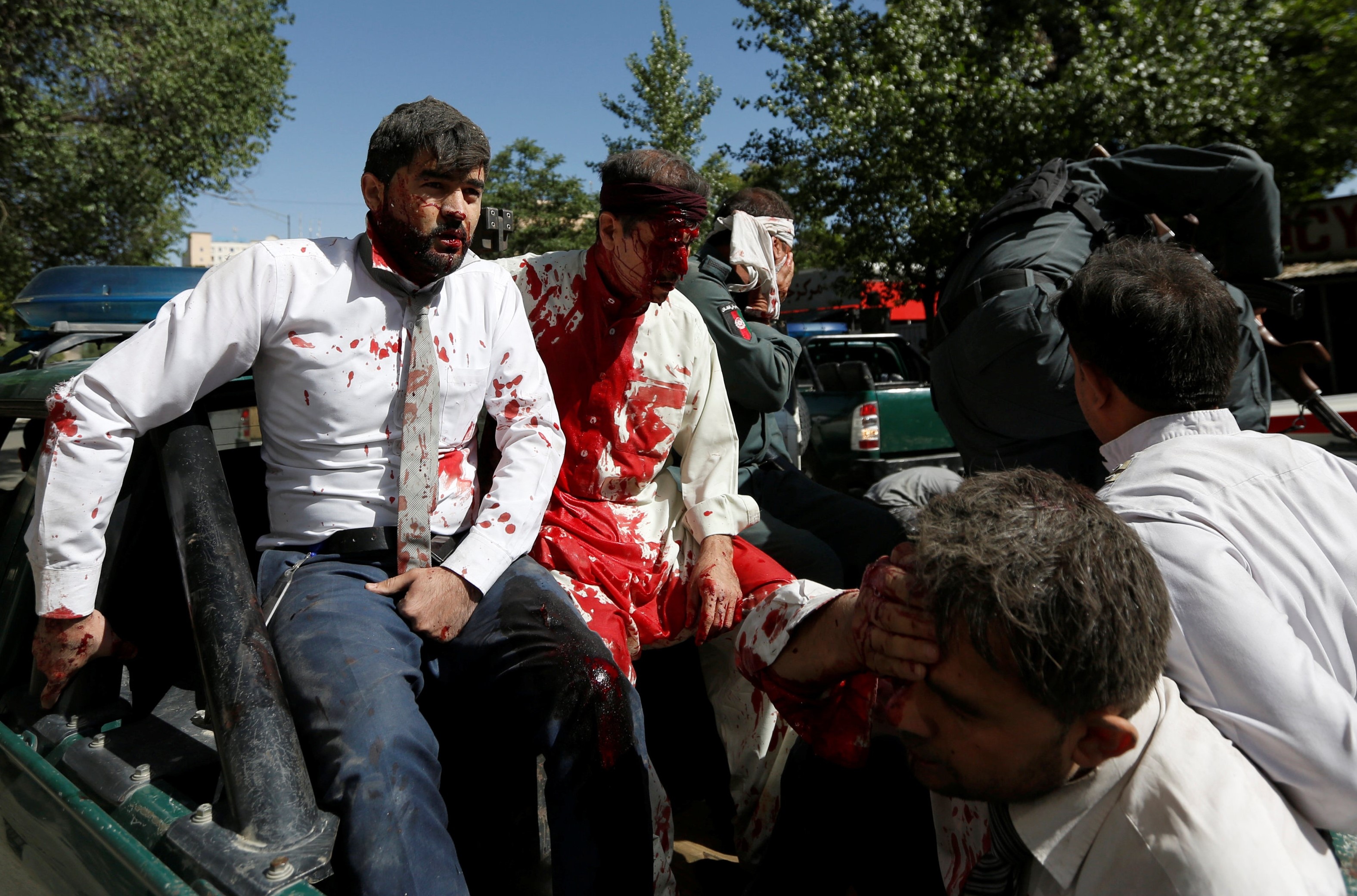 Hien truong vu danh bom kinh hoang o Kabul hinh anh