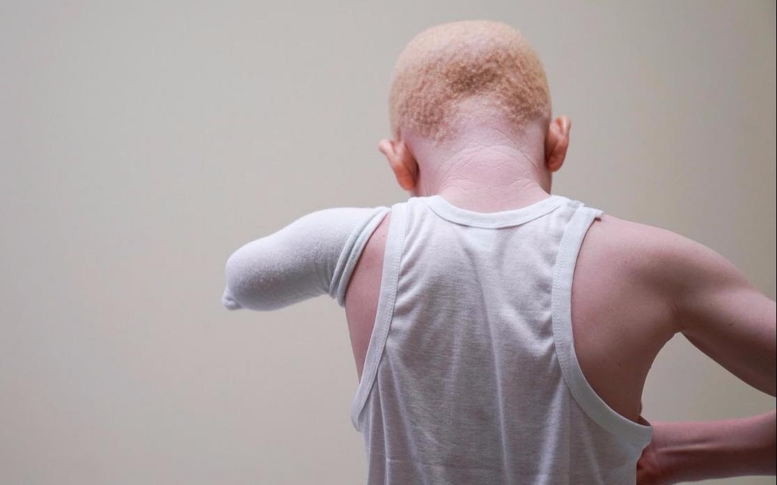 Nhung dua tre 'tai sinh' o My sau khi thoat ban tay phu thuy hinh anh