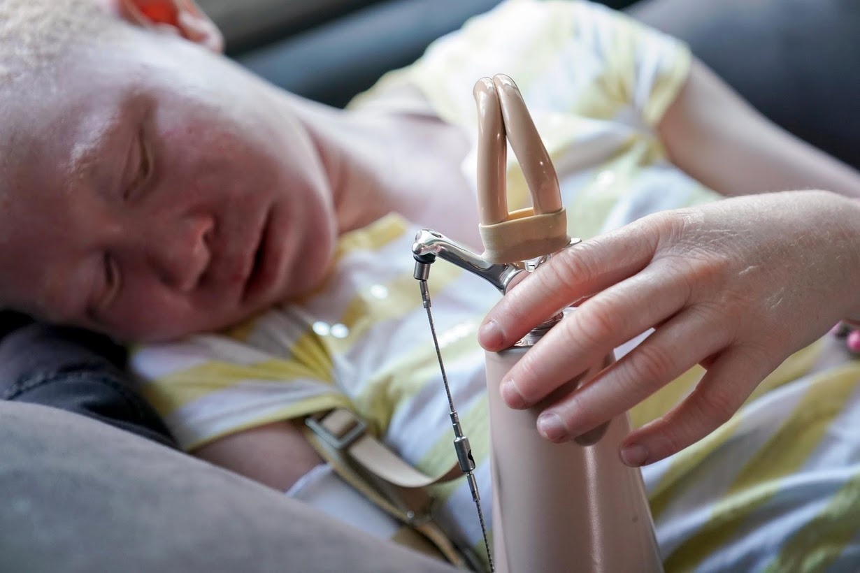 nhung dua tre bach tang o Tanzania anh 4