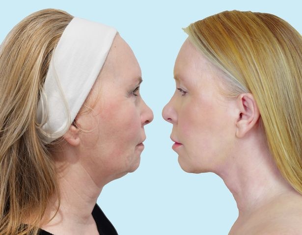 phẫu thuật thẩm mỹ ảnh 1 phau thuat tham my anh 1