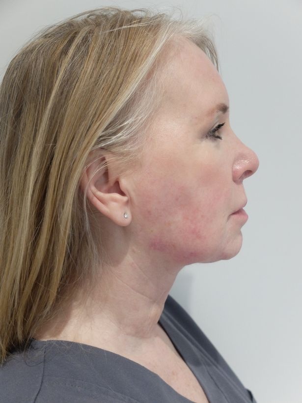 phẫu thuật thẩm mỹ ảnh 2 phau thuat tham my anh 2