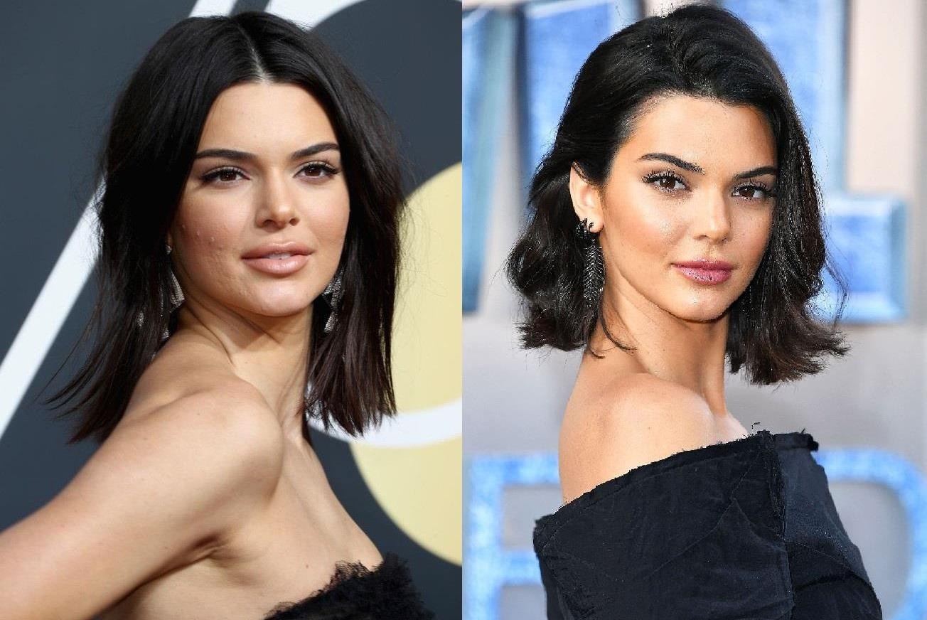 Kendall Jenner da lam gi khi moc day mun tren mat? hinh anh