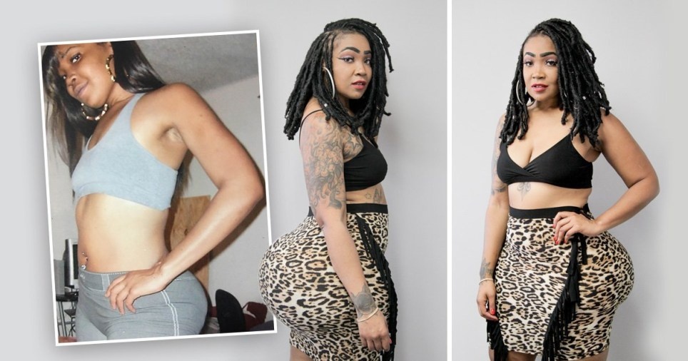 phau thuat mong hong anh 1