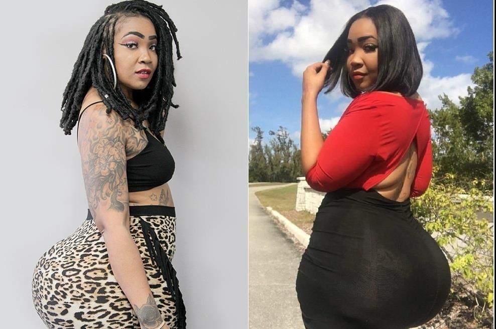 Bom mong 8 lan, nu nguoi mau co nguy co phai cat di vong 3 hinh anh