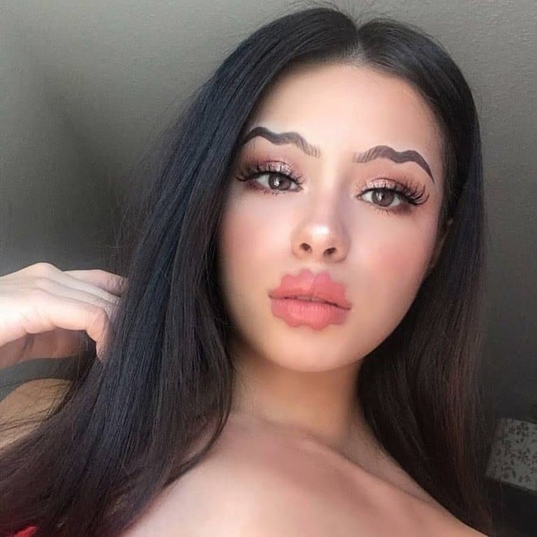 phau thuat moi anh 1