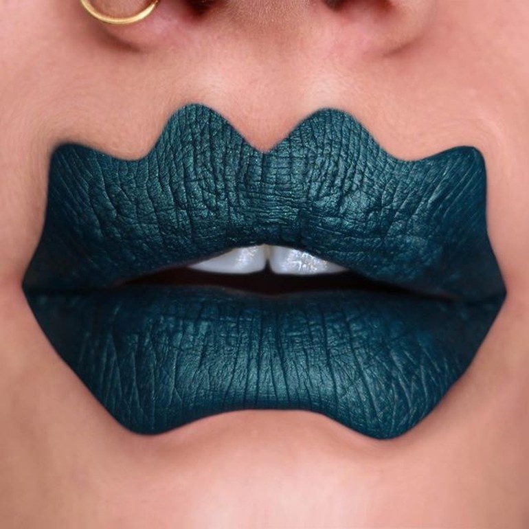 phau thuat moi anh 4