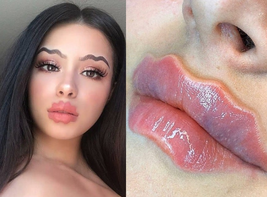 Mot lam moi bach tuoc cua nhieu co gai gay tranh cai hinh anh