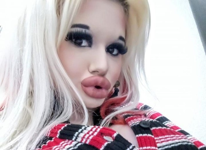 9X tiem axit 17 lan de co doi moi lon nhat the gioi hinh anh