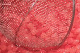 Cach lam mat na ngu dua hau bi mat cua nguoi Han Quoc hinh anh