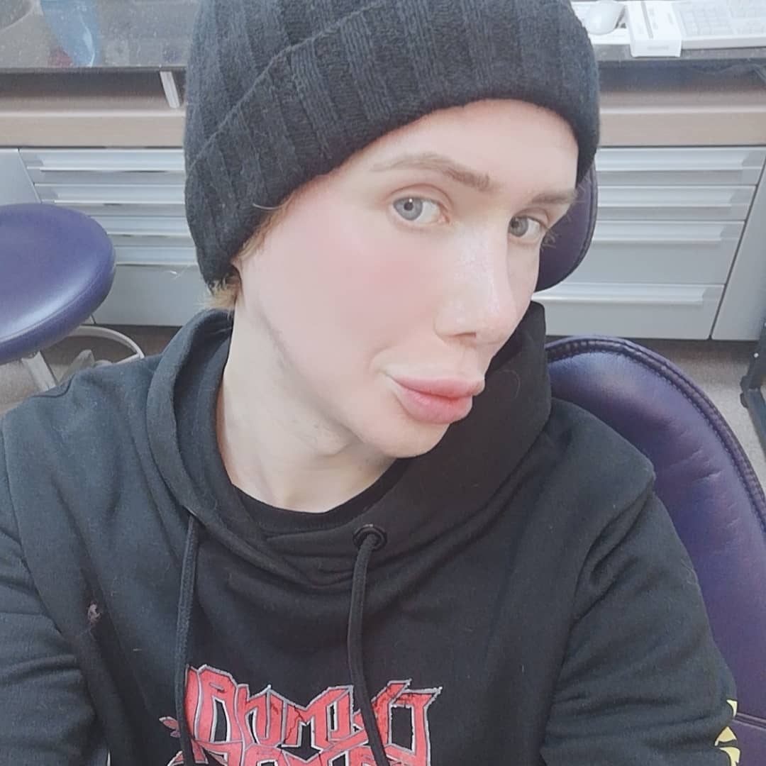 phau thuat tham my anh 2