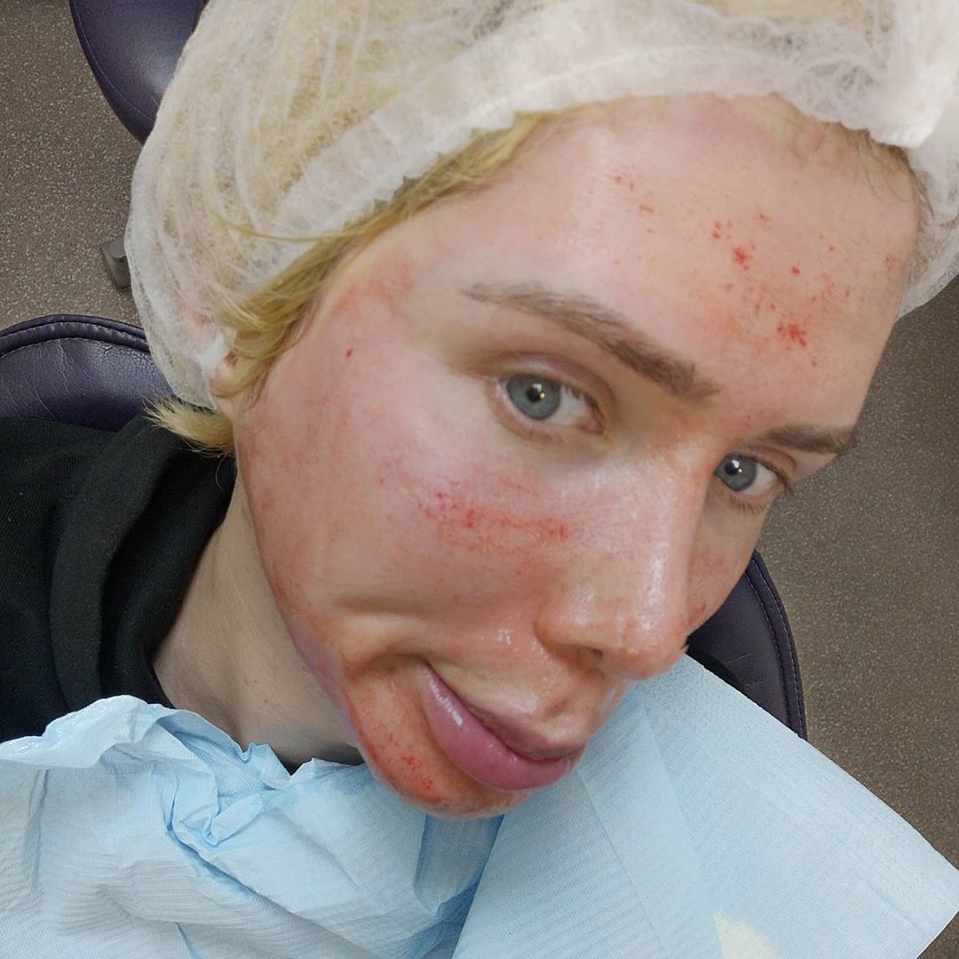 phau thuat tham my anh 1